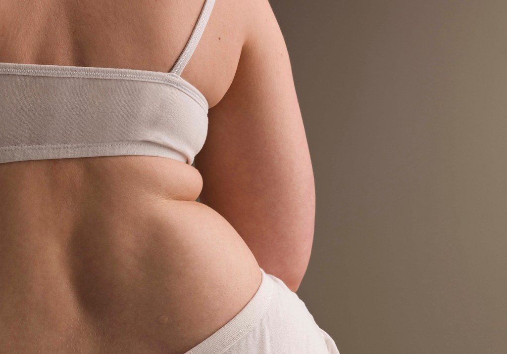 Existem mais obesos no mundo do que pessoas abaixo do peso normal, revela estudo