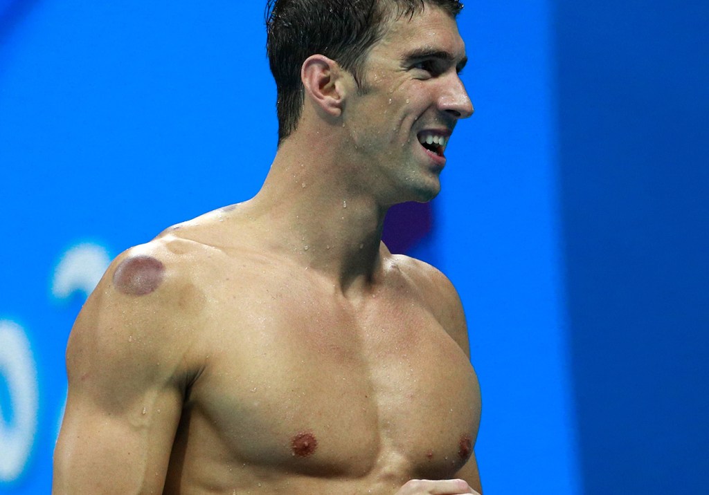Descobrimos o que são os pontos roxos nos ombros de Michael Phelps. Entenda!