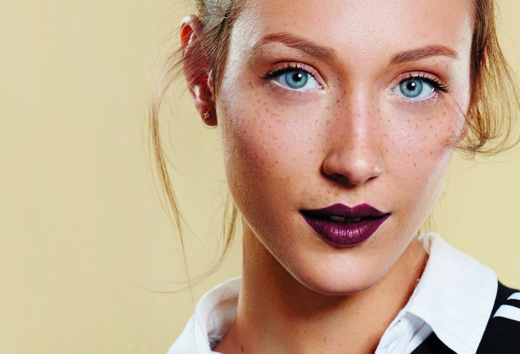 O que são as sardas?