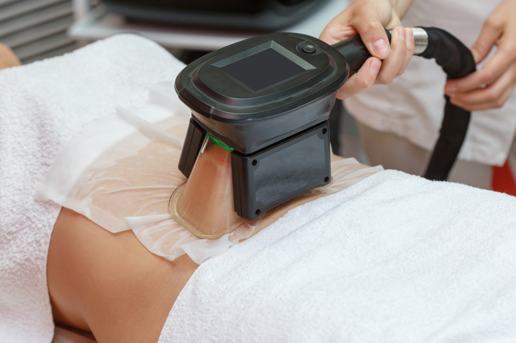 Woman getting cryolipolysis fat treatment in professional cosmetic cabinet abdomen lacrado