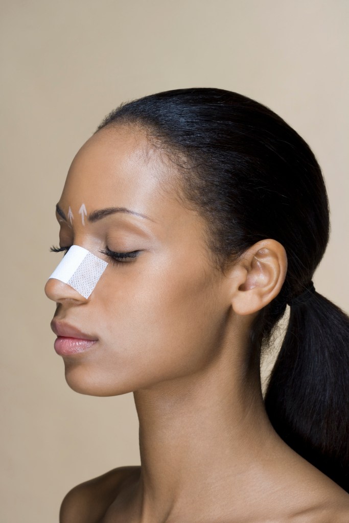 Portrait of a woman with her nose bandaged rinoplastia