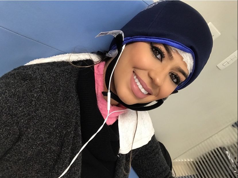 Crioterapia capilar preserva fios e autoestima de quem passa pela quimio