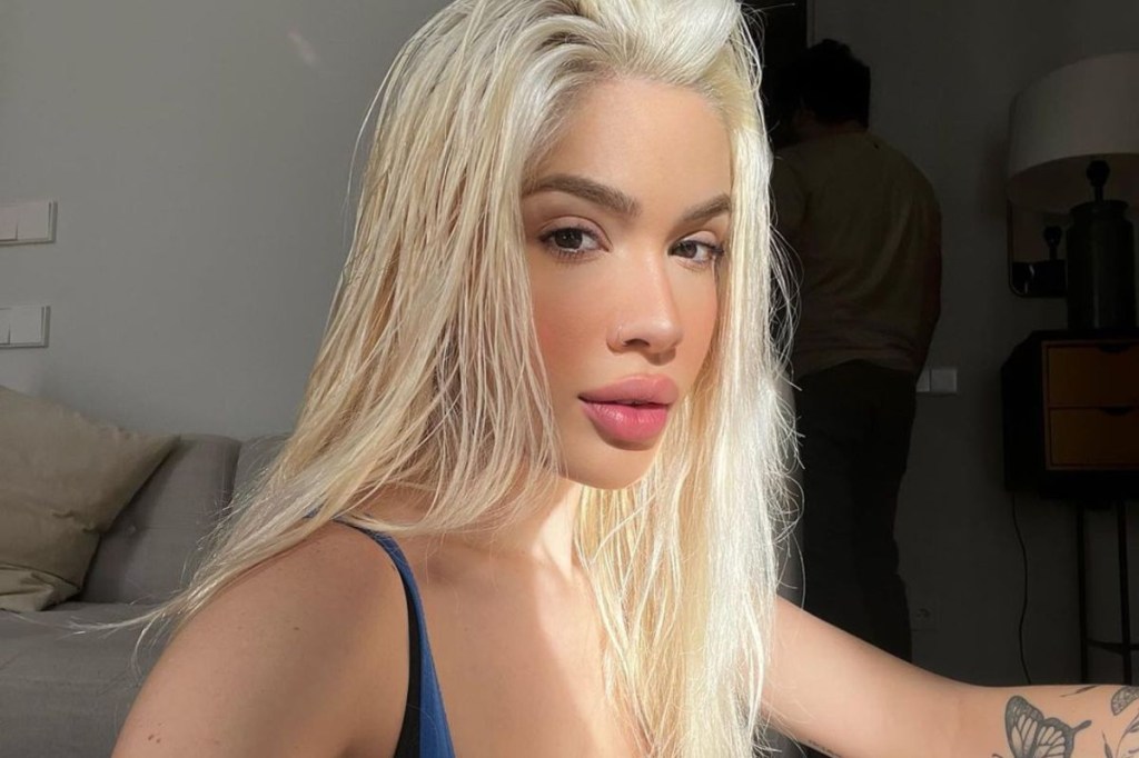 Karoline Lima faz botox no rosto. O que é o procedimento?