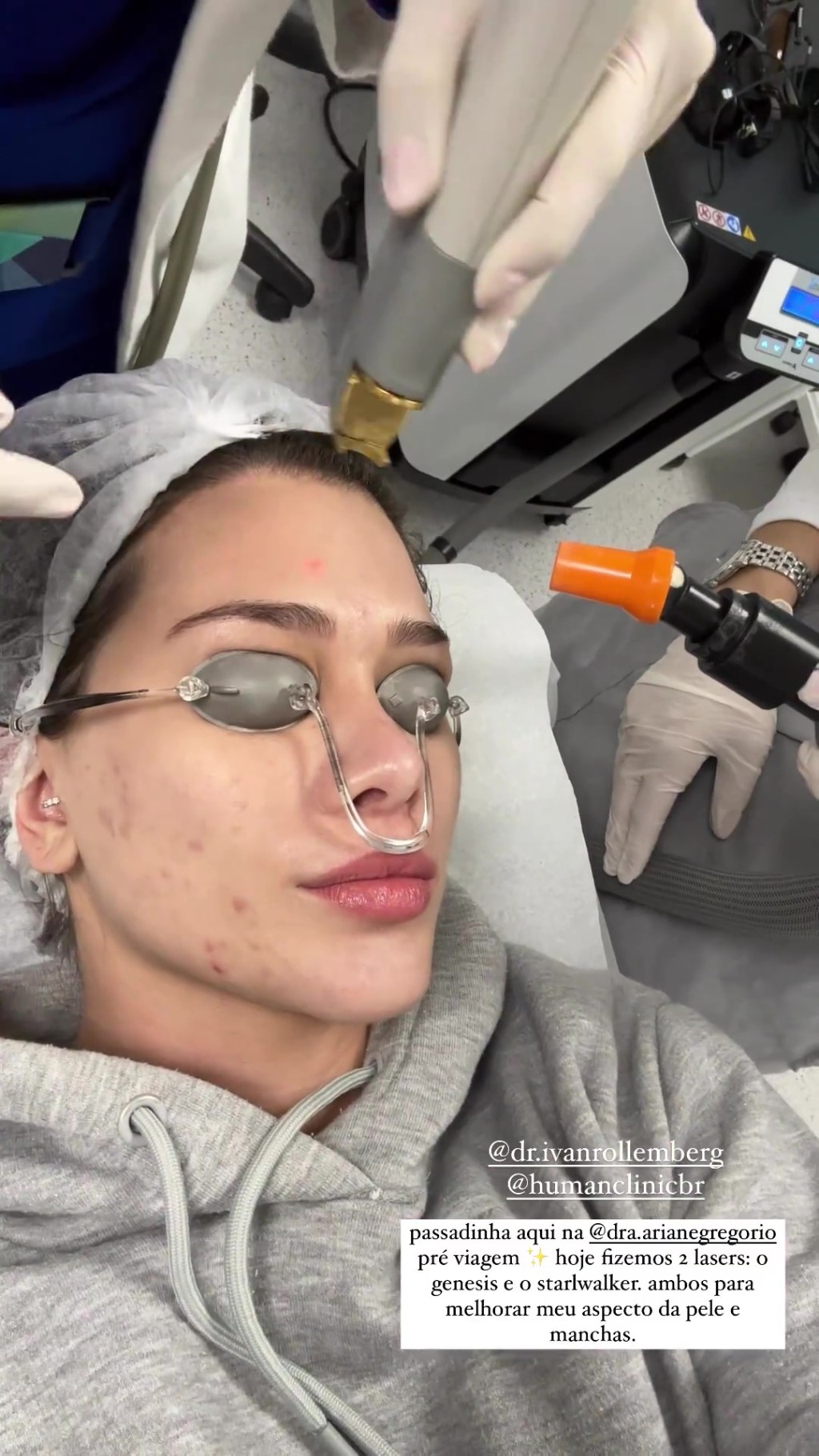 flaviapavanelli Flavia Pavanelli fazendo laser no rosto