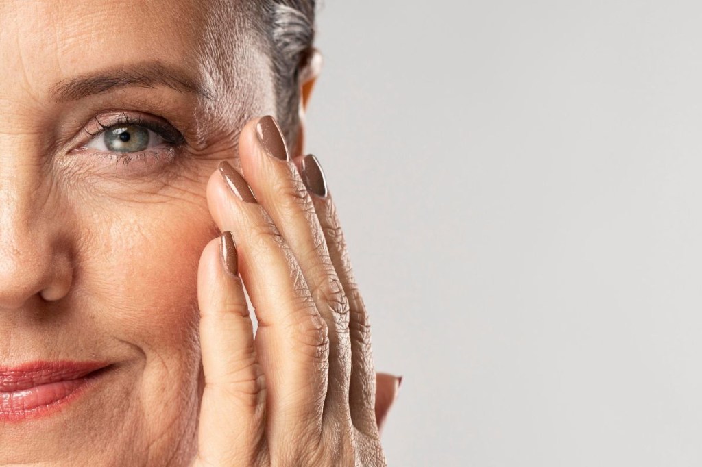 Rugas: entenda como se formam e como tratá-las