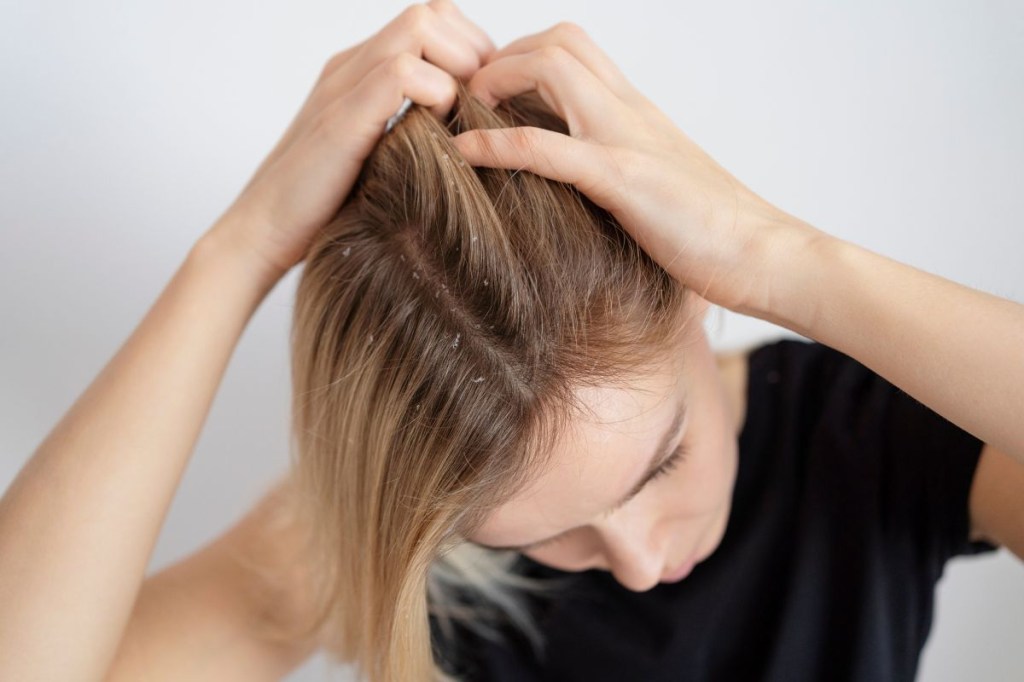Shampoo anticaspa: 8 opções para acabar de vez com o problema