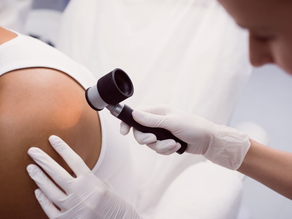 Hidradenite supurativa: o que é, causas e consequências psicológicas