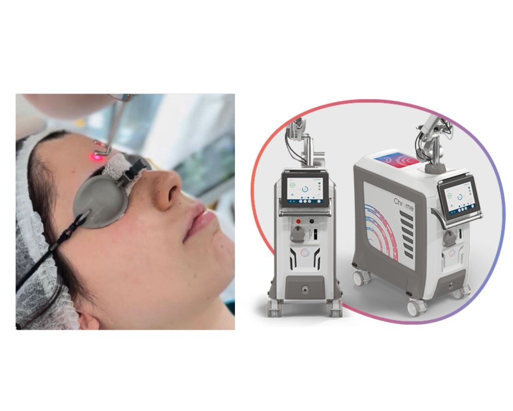 Chrome: experimentei o tratamento que é “a Ferrari dos lasers”