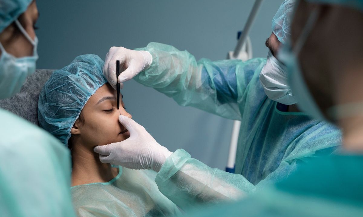 rinoplastia após a rinomodelação