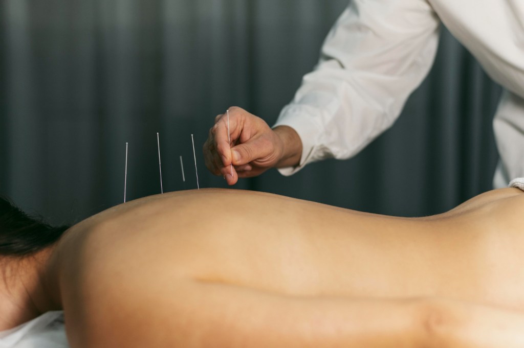 Terapias alternativas no câncer de mama: Yoga, Reiki, Acupuntura e mais