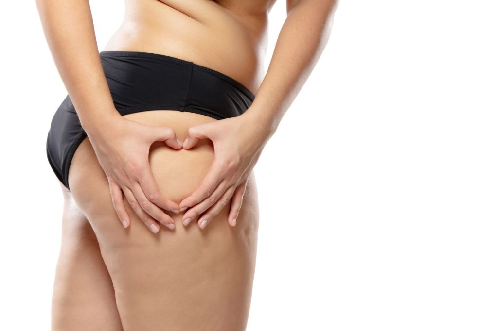 Lipedema e linfedema: entenda as diferenças