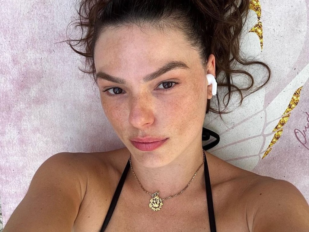 Doença celíaca: tudo sobre a condição que afeta Isis Valverde