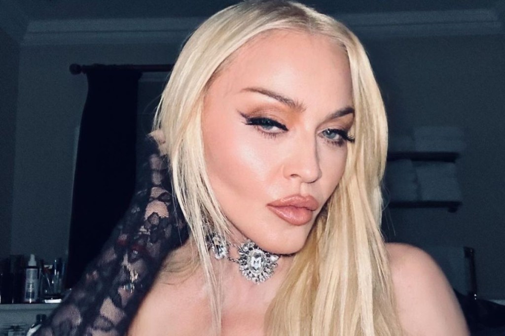 Madonna nunca toma sol: saiba se isso é recomendado