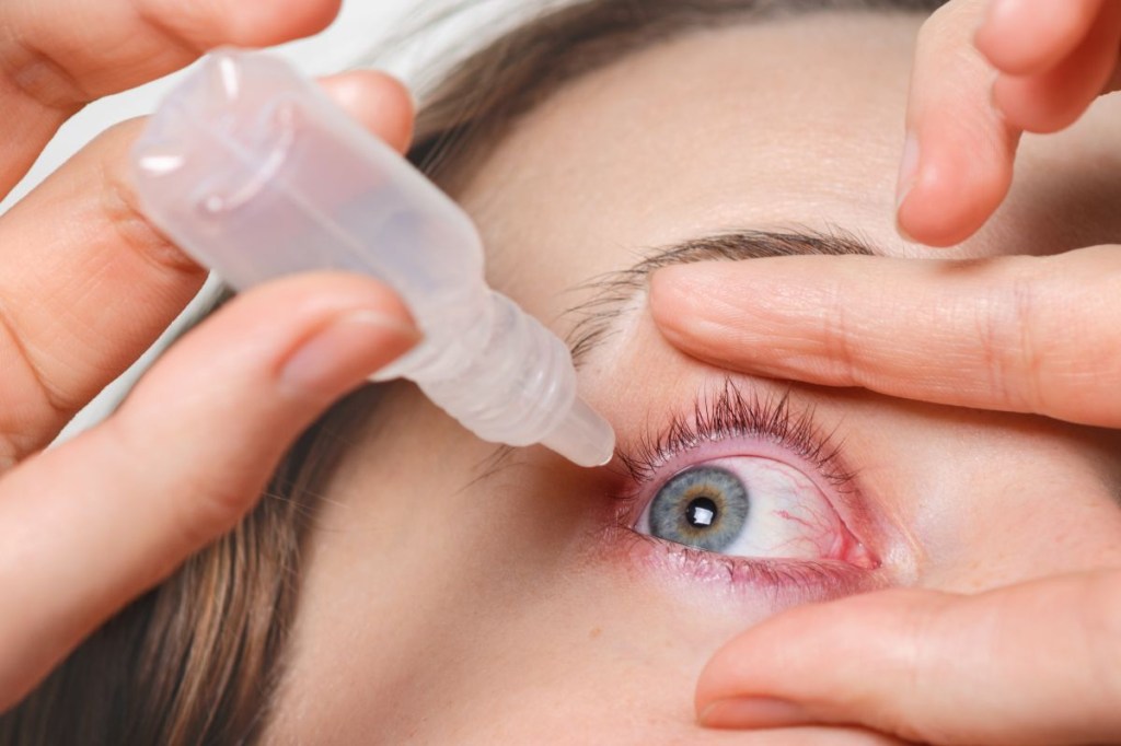 Conjuntivite: saiba como prevenir e tratar essa condição ocular