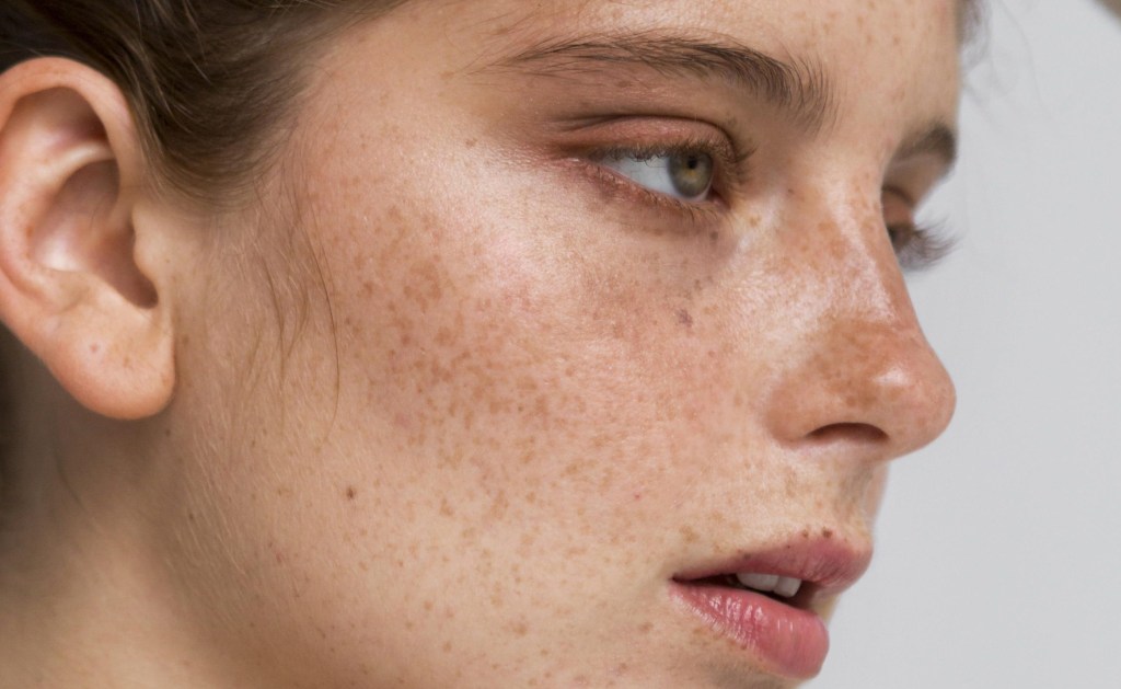 8 alimentos para adicionar ao cardápio se você tem melasma