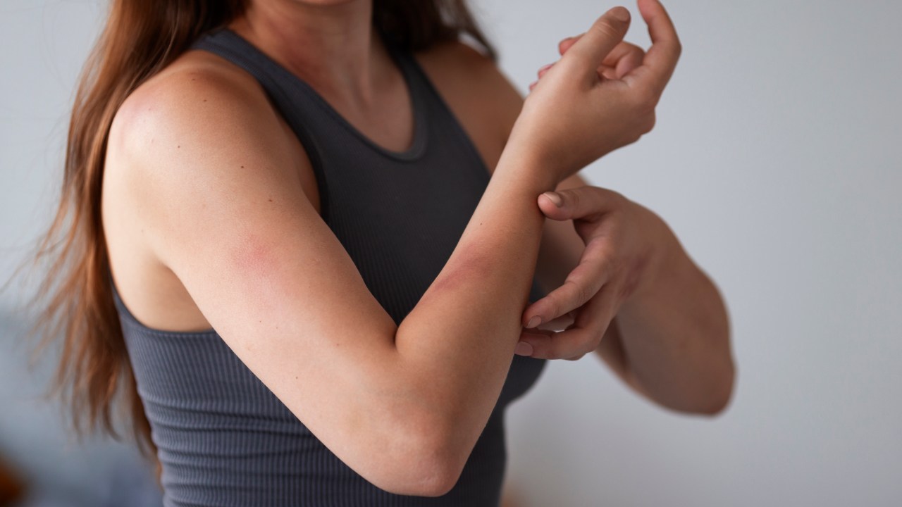 alergia emocional