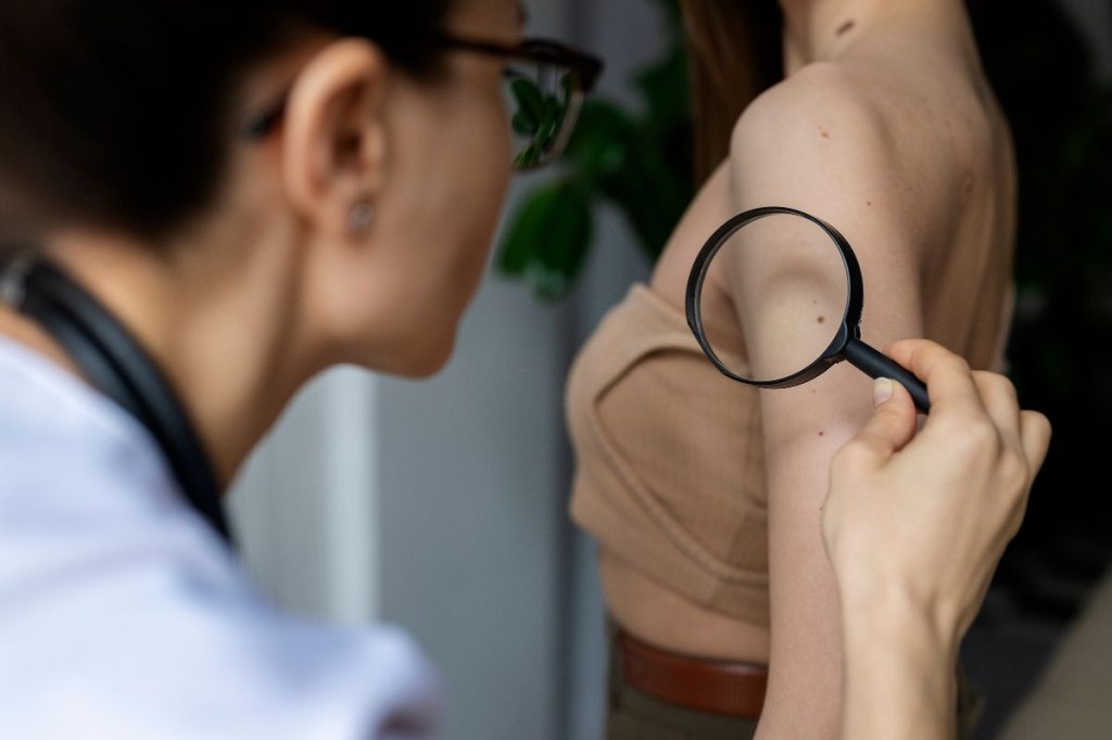 Dezembro Laranja: 5 dicas essenciais para proteger sua pele do câncer