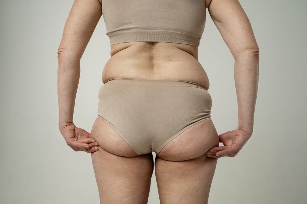 Combata a flacidez: exercícios simples para braços e pernas em qualquer lugar