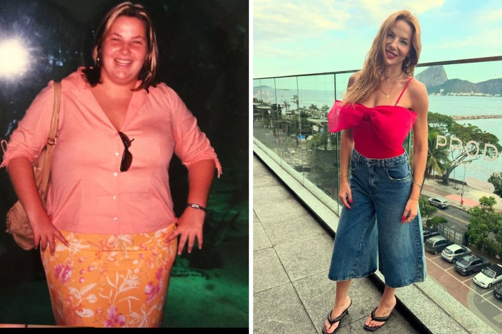 Luiza Zveiter reflete sobre a transformação do corpo após cirurgia bariátrica