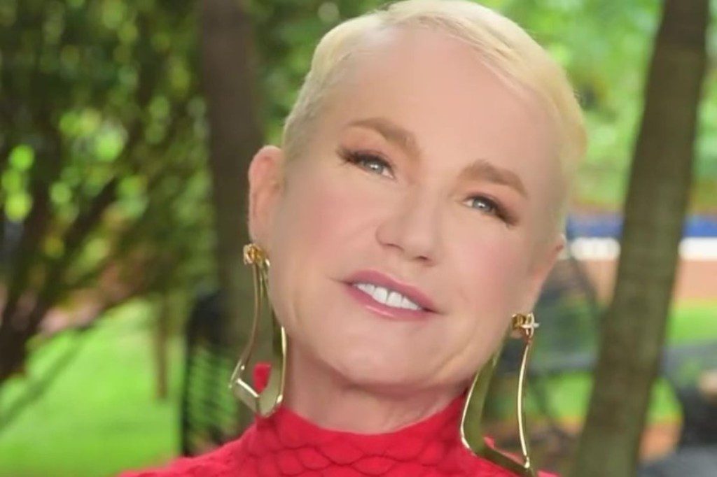 Entenda o transplante capilar que Xuxa fez para tratar a queda de cabelo
