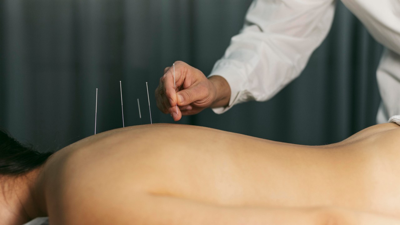Entenda tudo sobre a Medicina Chinesa